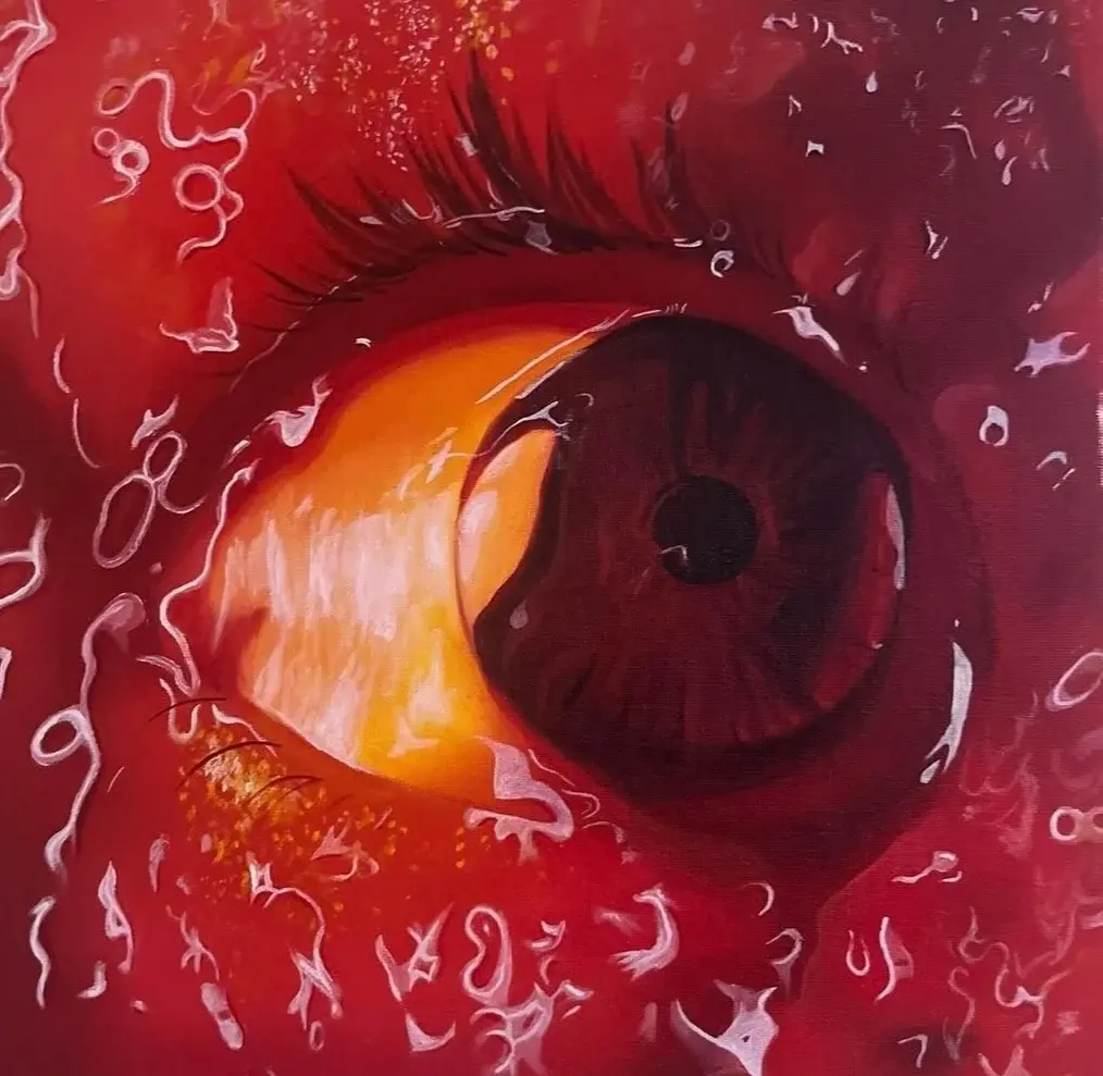 Red Eye Study